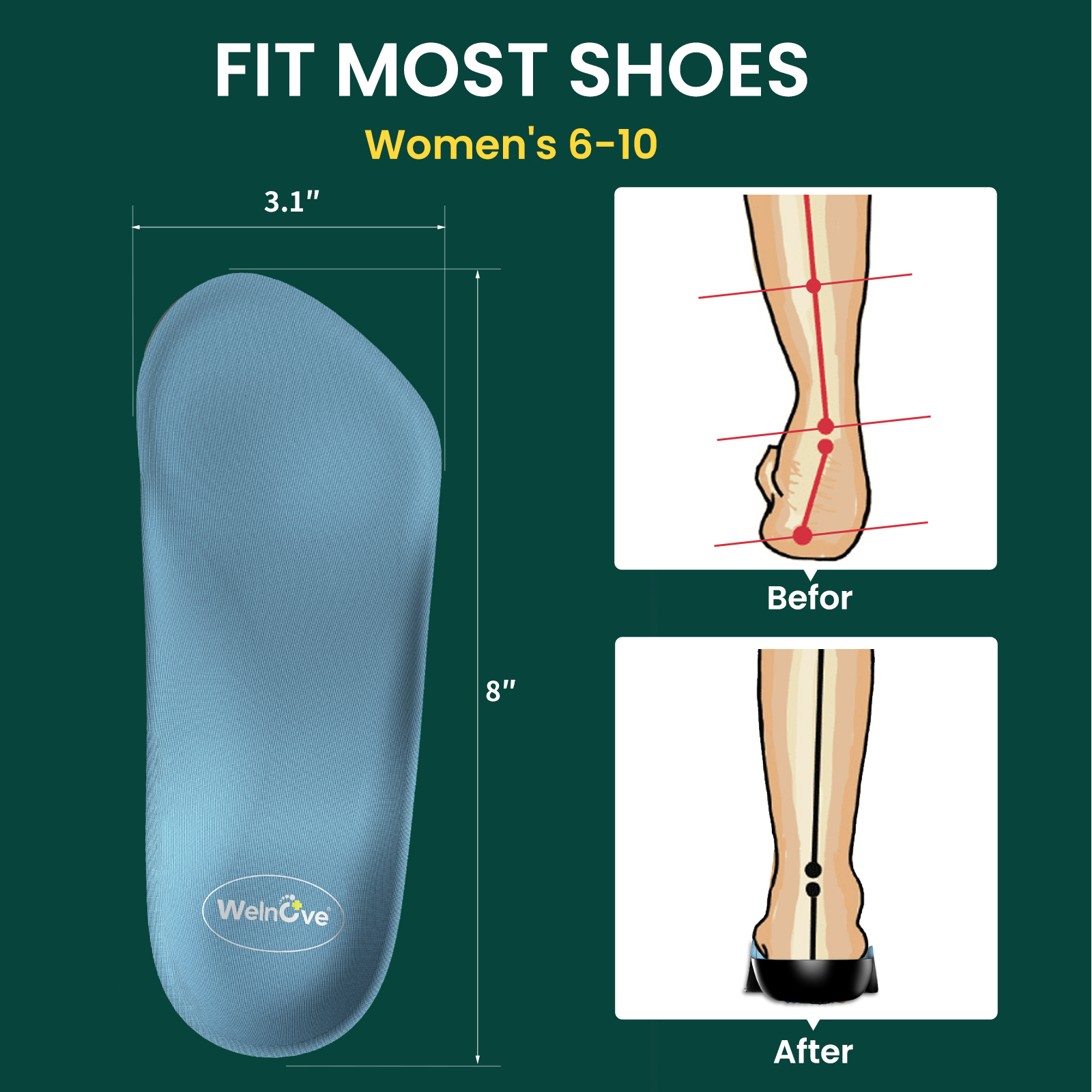2pcs Female Arch Support Pad O - Insole Arch Support 评论和价格
